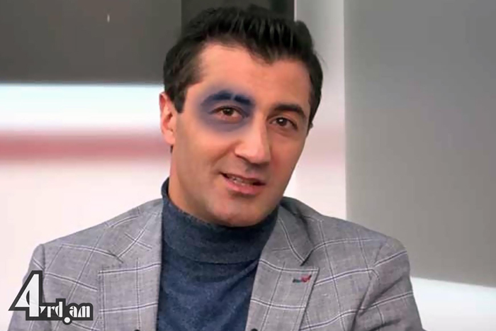 Կորմից զրկվածները